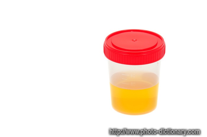 urine sample - photo/picture definition - urine sample word and phrase image