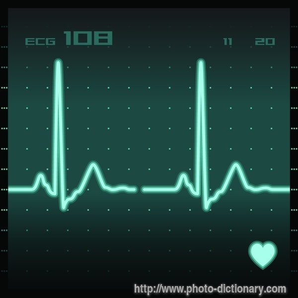 heart monitor - photo/picture definition - heart monitor word and phrase image