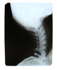 neck x-ray - photo/picture definition - neck x-ray word and phrase image