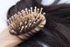 hairloss - photo/picture definition - hairloss word and phrase image