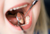 dental check up - photo/picture definition - dental check up word and phrase image